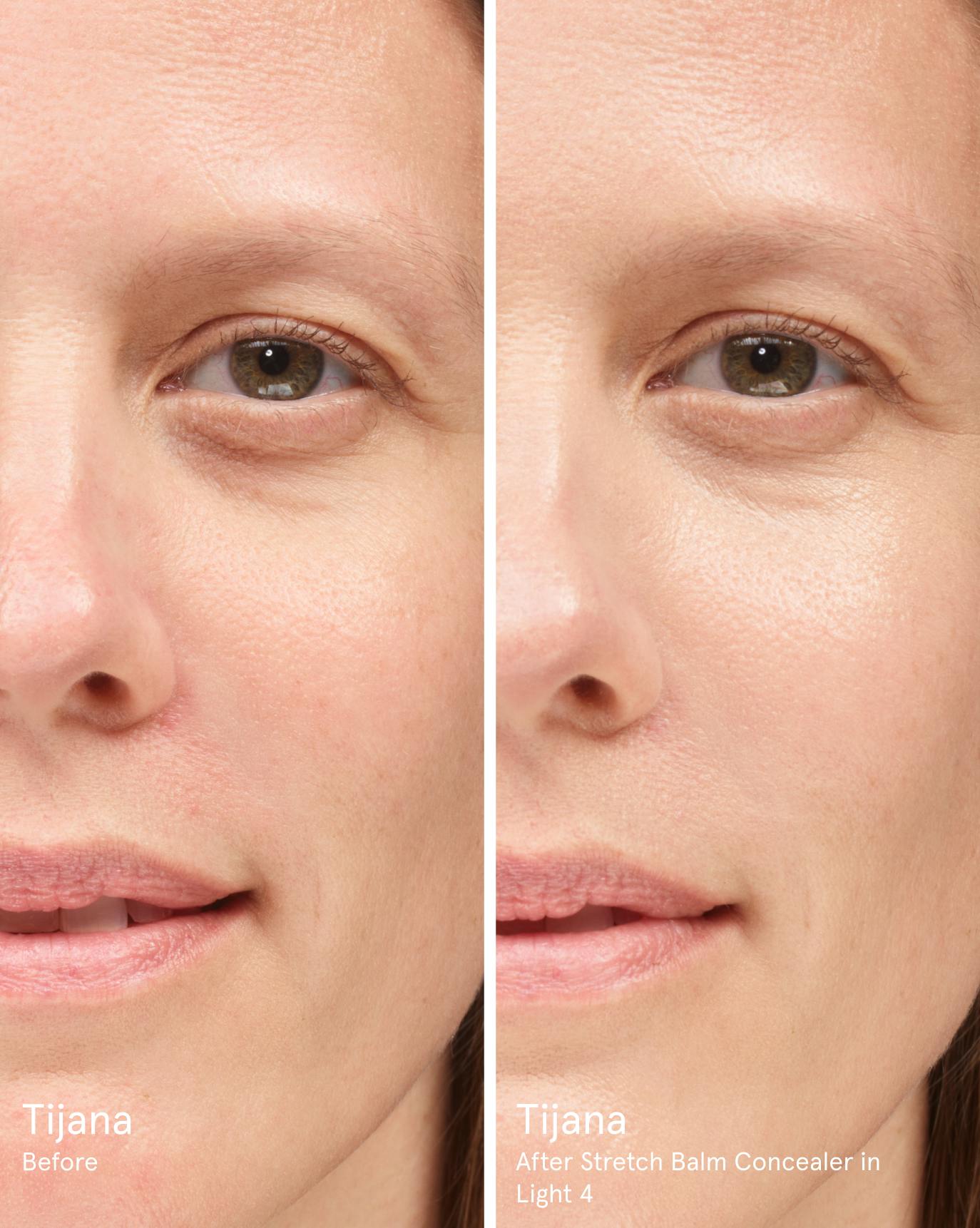 Tijana before. After Stretch Balm Concealer in L4.