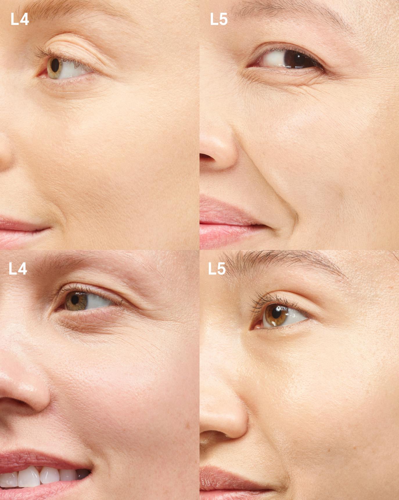comparison foundation