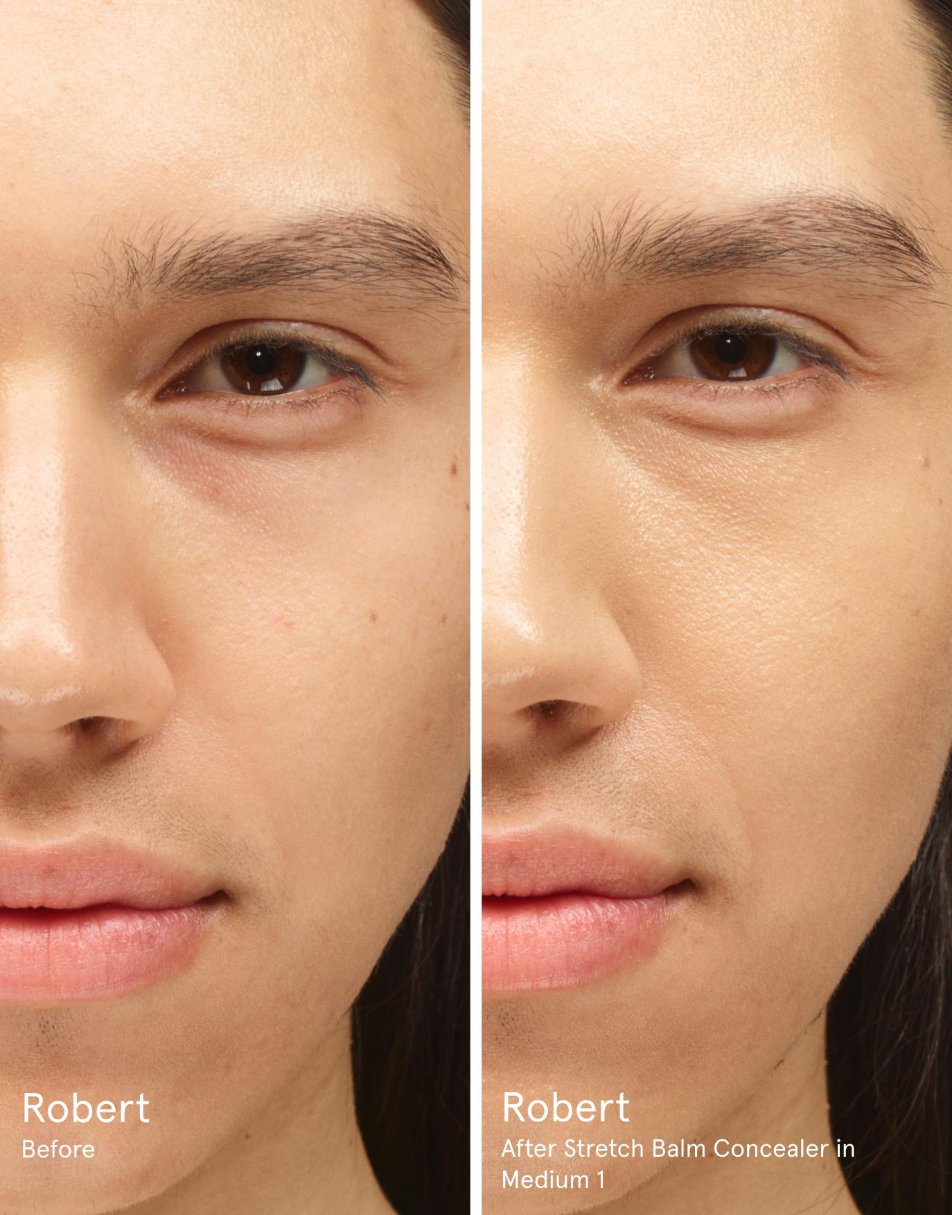 Robert before. After Stretch Balm Concealer in M1.