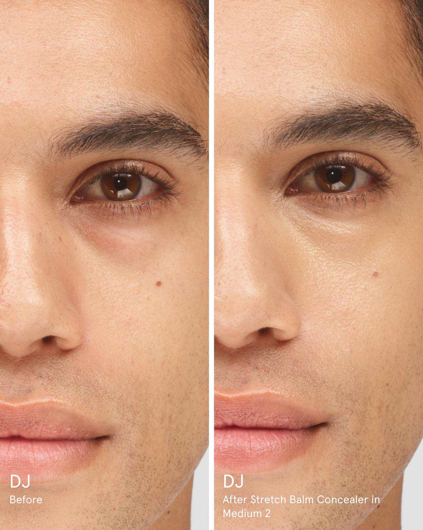 DJ before. After Stretch Balm Concealer in M2.