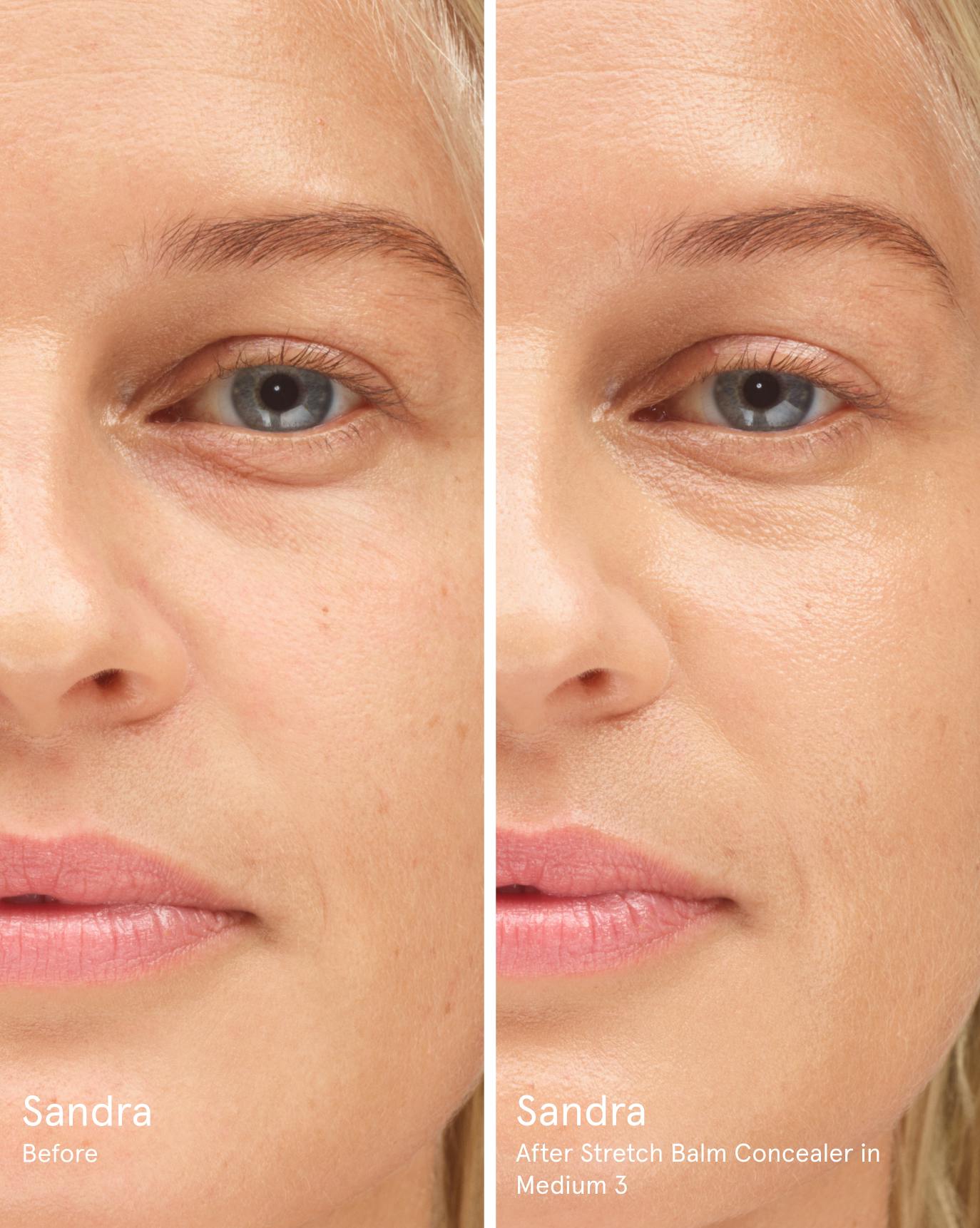 Sandra before. After Stretch Balm Concealer in M3.
