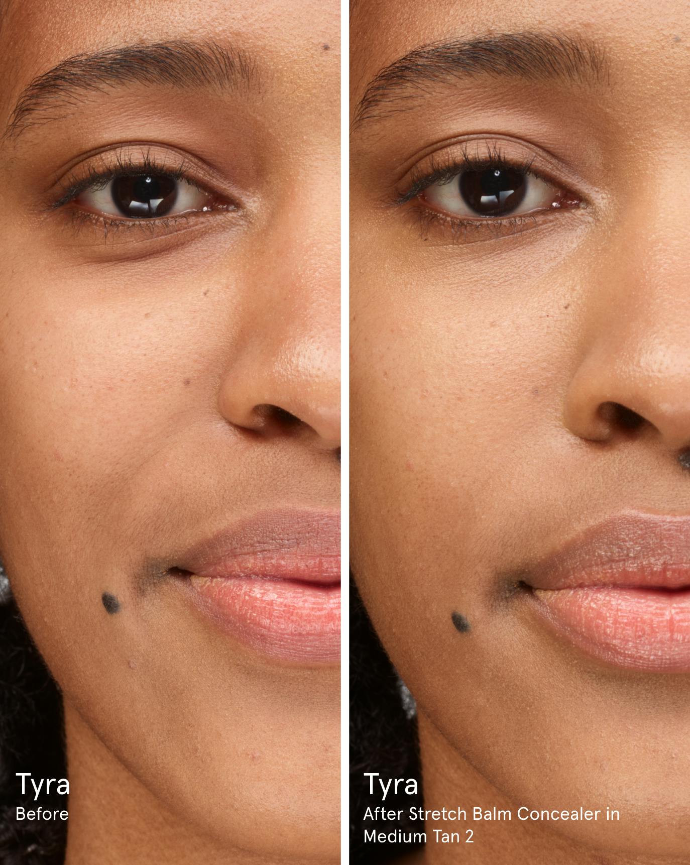 Tyra before. After Stretch Balm Concealer in MT2.