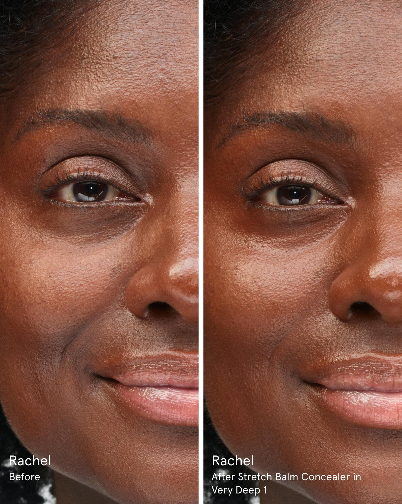 Rachel before. After Stretch Balm Concealer in VD1.