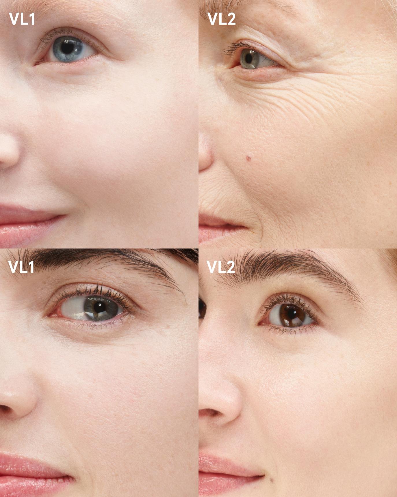 comparison foundation