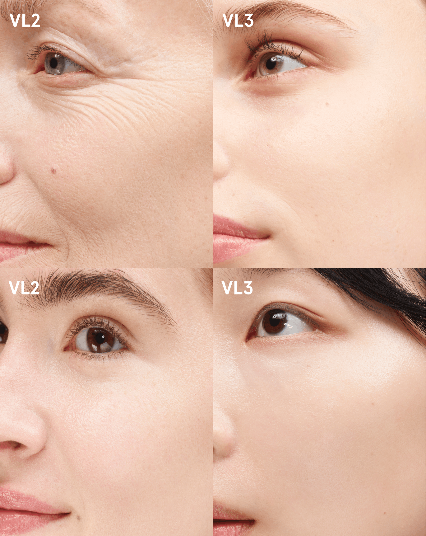 comparison foundation