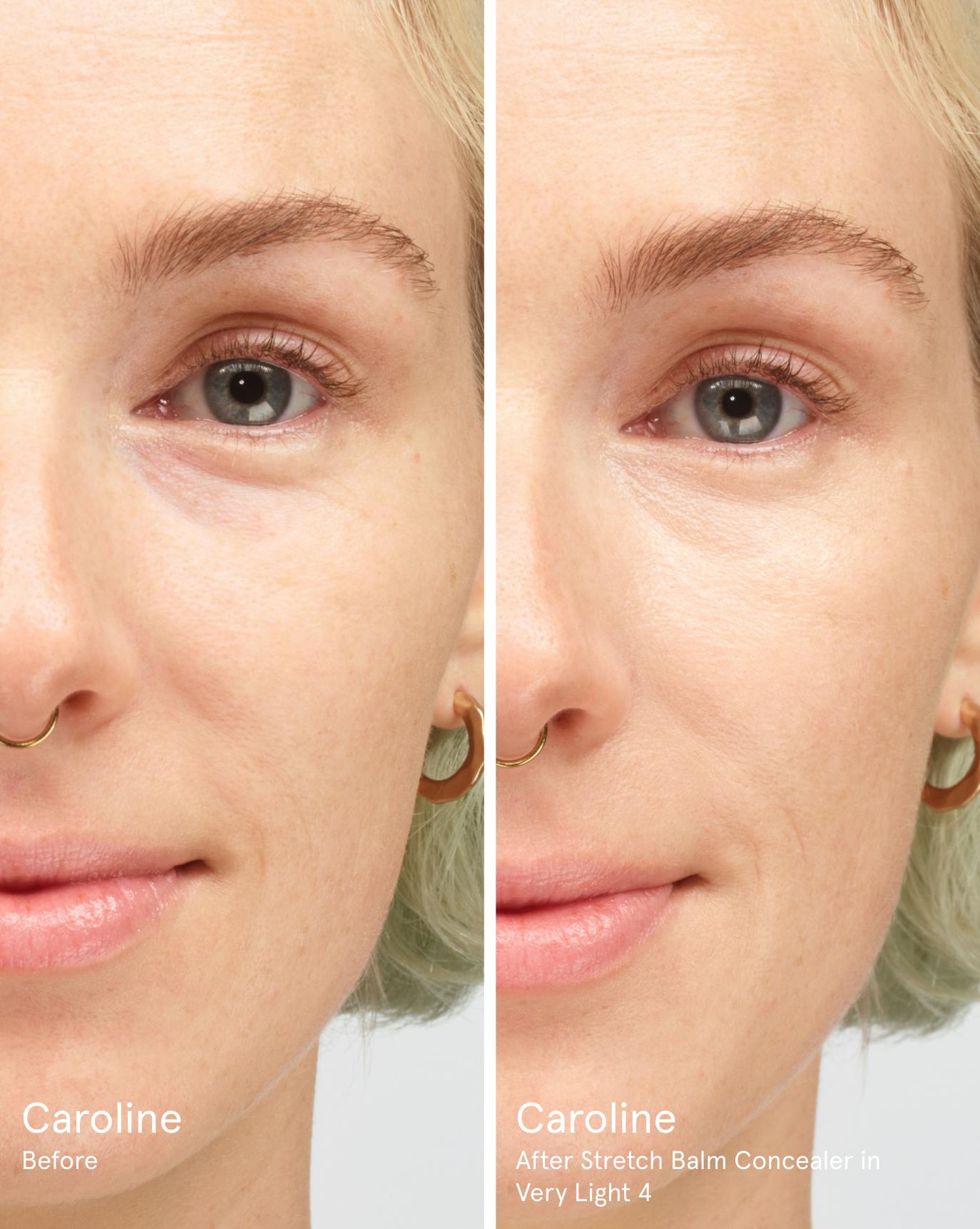 Caroline before. After Stretch Balm Concealer in VL4.