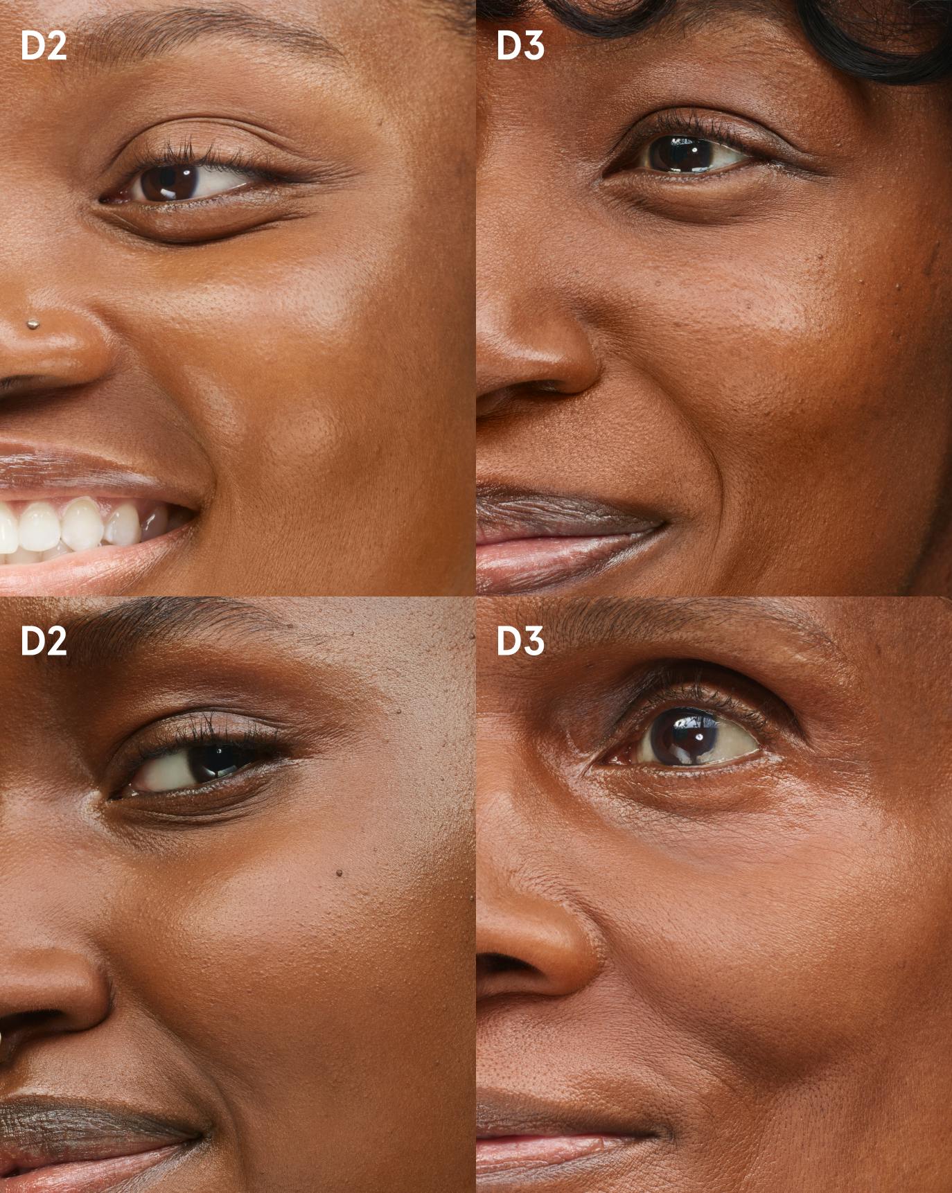 comparison foundation