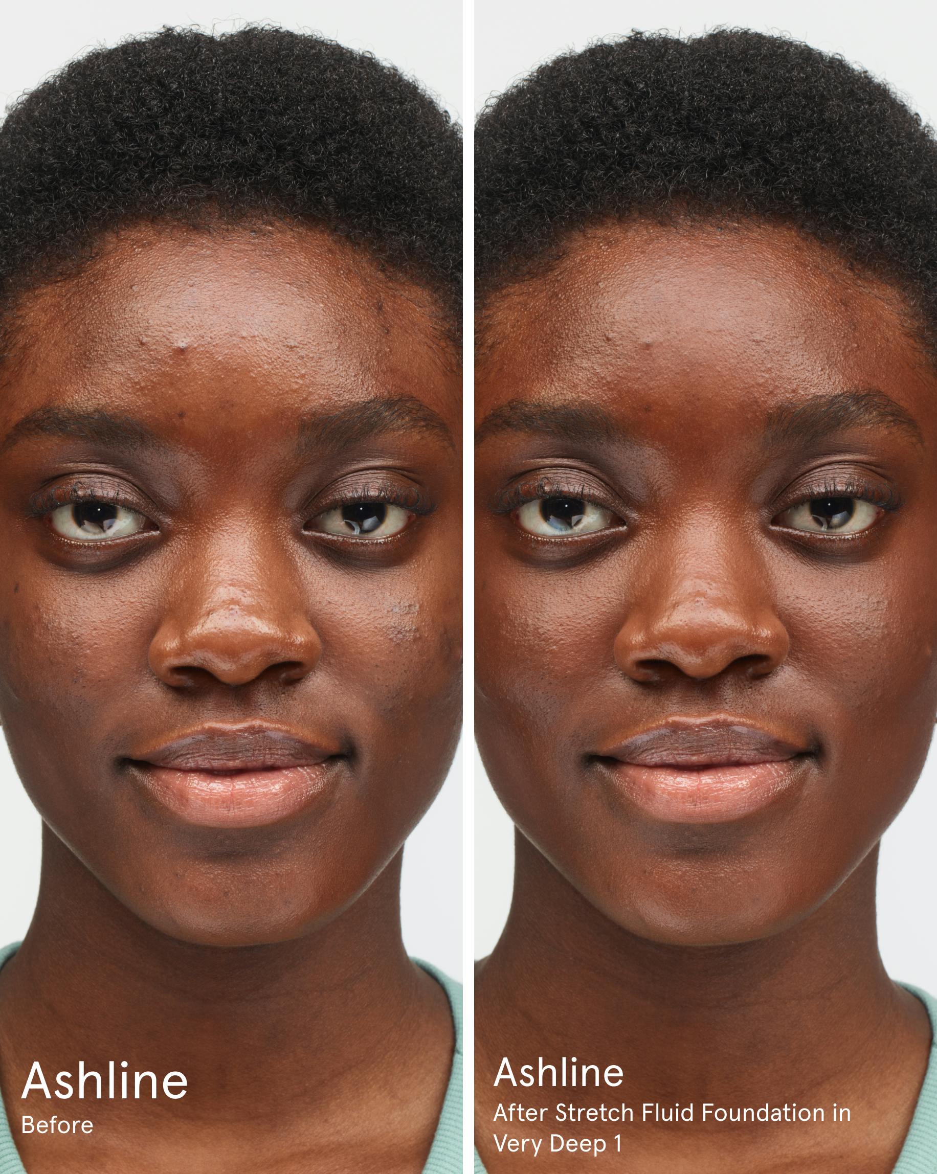 Ashline before. After Stretch Fluid Foundation in VD1.