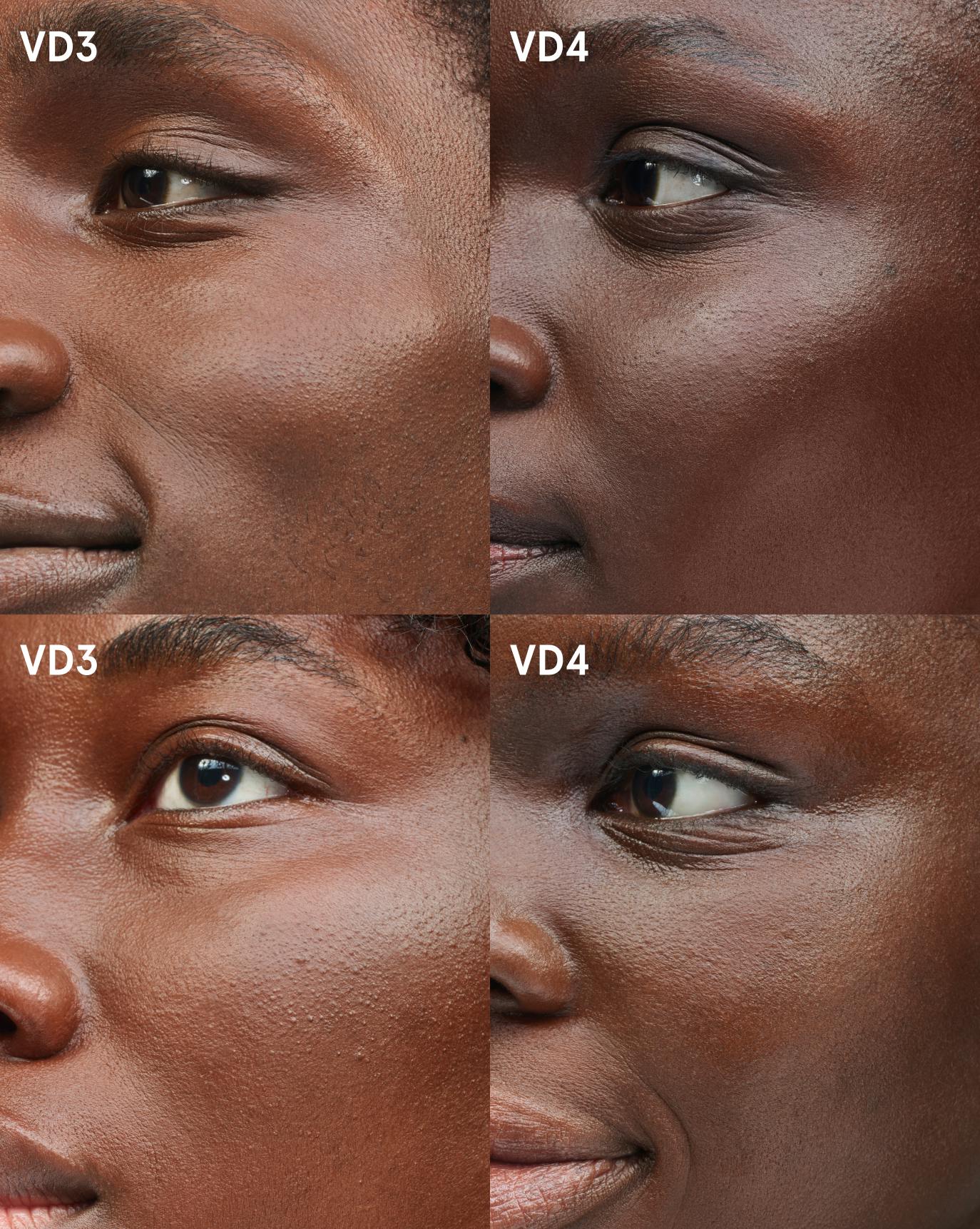 comparison foundation