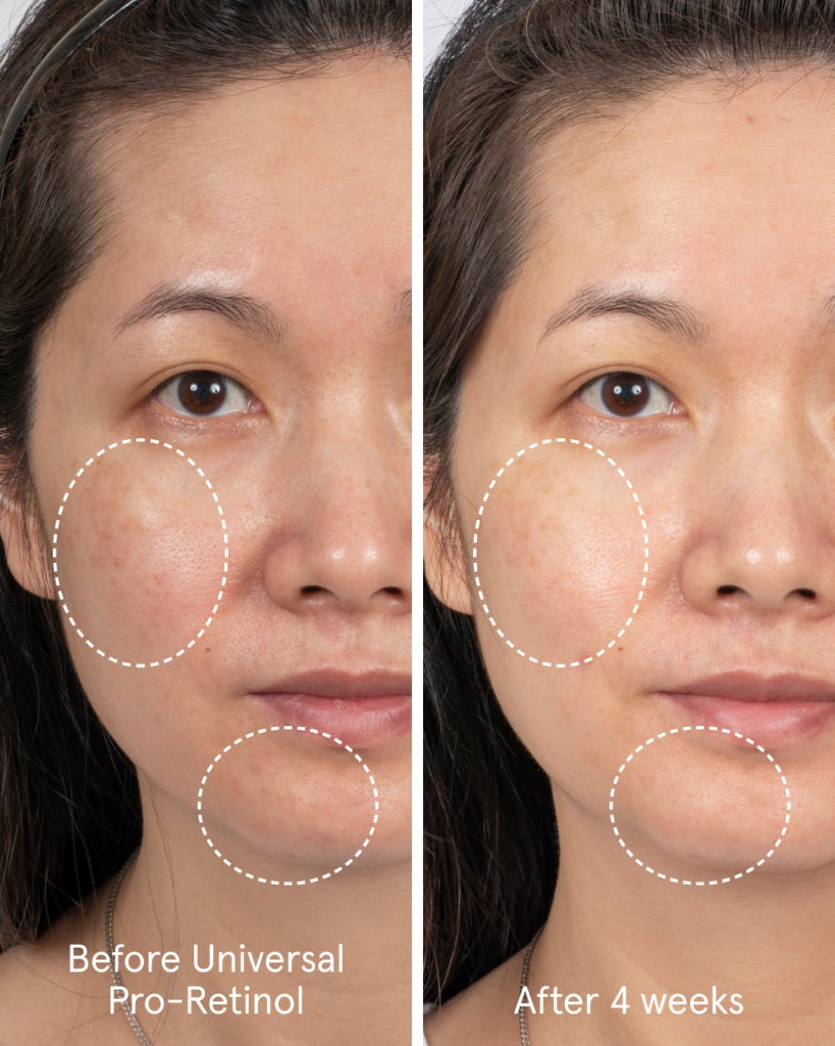 Model shot showing unretouched photos of before and after four weeks of using Universal Pro-Retinol