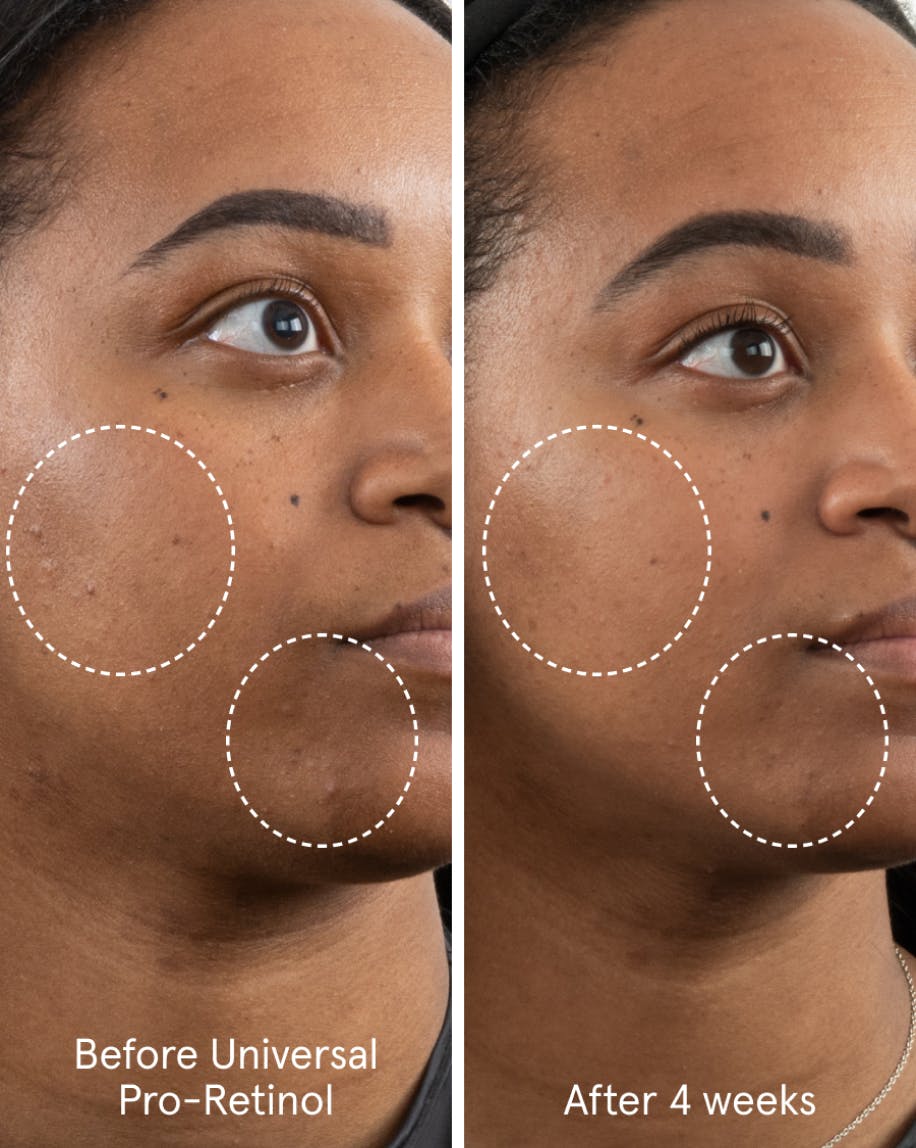 universal-pro-retinol-glossier